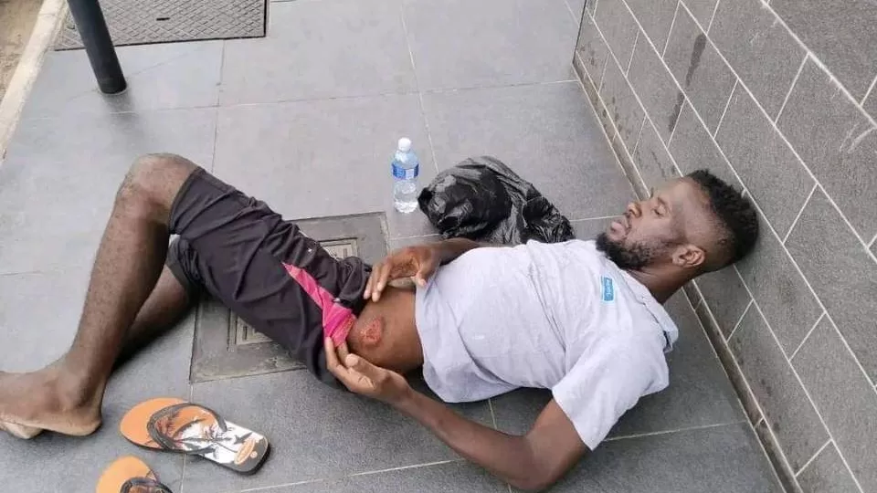 Former PSL goalkeeper Bongani Manavhela shows his injuries from the hijacking